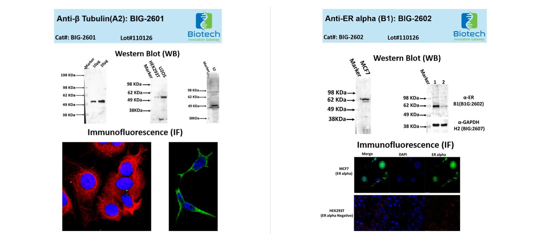 Anti-Beta-Tubulin and Anti-ER alpha antibody validation data